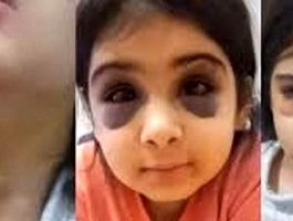 ماجرای کودک آزاری «آنیلا» در سنندج