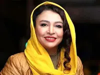 چهره متفاوت مهلقا باقری بعد از عمل زیبایی جلب توجه کرد